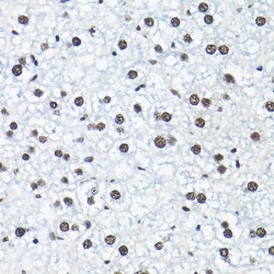 Small Nuclear Ribonucleoprotein Polypeptide A' (SNRPA1) Antibody