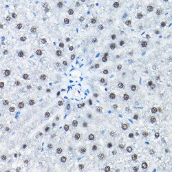 Small Nuclear Ribonucleoprotein Polypeptide A' (SNRPA1) Antibody