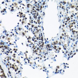 Small Nuclear Ribonucleoprotein Polypeptide A' (SNRPA1) Antibody