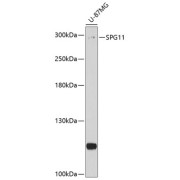 Western blot analysis of lysates from U-87MG cells, using SPG11 Antibody at 1/1000 dilution. Secondary antibody: HRP-conjugated Goat anti-Rabbit IgG (H+L) at 1/10000 dilution. Lysates/proteins: 25 µg per lane. Blocking buffer: 3% nonfat dry milk in TBST. Exposure time: 90s.