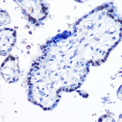 Signal Transducer And Activator of Transcription 5B (STAT5B) Antibody