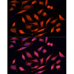 Serine/Threonine Kinase 24 (STK24) Antibody