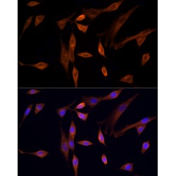 Serine/Threonine Kinase 24 (STK24) Antibody