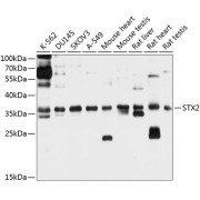 Western blot analysis of various lysates using STX2 Antibody at 1/1000 dilution. Secondary antibody: HRP-conjugated Goat anti-Rabbit IgG (H+L) at 1/10000 dilution. Lysates/proteins: 25 µg per lane. Blocking buffer: 3% nonfat dry milk in TBST. Exposure time: 10s.