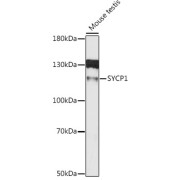 Western blot analysis of lysates from mouse testis, using SYCP1 Antibody at 1/1000 dilution. Secondary antibody: HRP-conjugated Goat anti-Rabbit IgG (H+L) at 1/10000 dilution. Lysates/proteins: 25 µg per lane. Blocking buffer: 3% nonfat dry milk in TBST. Exposure time: 90s.