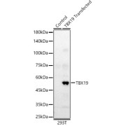 Western blot analysis of lysates from wild type (WT) and 293T cells transfected with TBX19, using TBX19 Antibody at 1/2500 dilution. Secondary antibody: HRP-conjugated Goat anti-Rabbit IgG (H+L) at 1/10000 dilution. Lysates/proteins: 25 µg per lane. Blocking buffer: 3% nonfat dry milk in TBST. Exposure time: 60s.