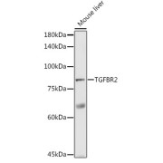 Western blot analysis of lysates from Mouse liver, using TGF beta Receptor II (TGFBR2) Antibody at 1/1000 dilution. Secondary antibody: HRP-conjugated Goat anti-Rabbit IgG (H+L) at 1/10000 dilution. Lysates/proteins: 25 µg per lane. Blocking buffer: 3% nonfat dry milk in TBST. Exposure time: 90s.