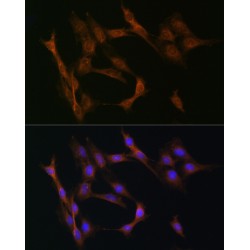 Transforming Growth Factor Beta Receptor 2 (TGFBR2) Antibody