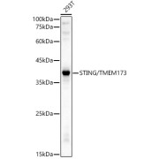 Western blot analysis of lysates from 293T cells, using STING/TMEM173 Antibody at 1/3000 dilution. Secondary antibody: HRP-conjugated Goat anti-Rabbit IgG (H+L) at 1/10000 dilution. Lysates/proteins: 25 µg per lane. Blocking buffer: 3% nonfat dry milk in TBST. Exposure time: 10s.