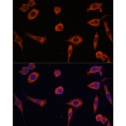 Stimulator of Interferon Genes Protein / TMEM173 (STING1) Antibody