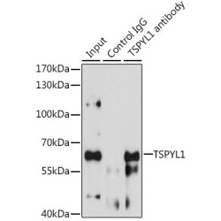 Testis-Specific Y-Encoded-Like Protein 1 (TSPYL1) Antibody