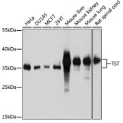 Western blot analysis of various lysates using TST Antibody at 1/1000 dilution. Secondary antibody: HRP-conjugated Goat anti-Rabbit IgG (H+L) at 1/10000 dilution. Lysates/proteins: 25 µg per lane. Blocking buffer: 3% nonfat dry milk in TBST. Exposure time: 5s.