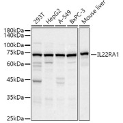 Western blot analysis of various lysates using IL22RA1 Antibody at 1/500 dilution. Secondary antibody: HRP-conjugated Goat anti-Rabbit IgG (H+L) at 1/10000 dilution. Lysates/proteins: 25 µg per lane. Blocking buffer: 3% nonfat dry milk in TBST. Exposure time: 10s.