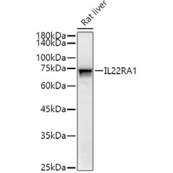 Interleukin 22 Receptor Subunit Alpha 1 (IL22RA1) Antibody