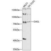 Western blot analysis of various lysates using OASL Antibody at 1/1000 dilution. Secondary antibody: HRP-conjugated Goat anti-Rabbit IgG (H+L) at 1/10000 dilution. Lysates/proteins: 25 µg per lane. Blocking buffer: 3% nonfat dry milk in TBST. Exposure time: 60s.