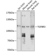 Western blot analysis of various lysates using TGFBR3 Antibody at 1/1000 dilution. Secondary antibody: HRP-conjugated Goat anti-Rabbit IgG (H+L) at 1/10000 dilution. Lysates/proteins: 25 µg per lane. Blocking buffer: 3% nonfat dry milk in TBST. Exposure time: 10s.