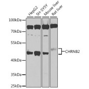 Western blot analysis of various lysates using CHRNB2 Antibody at 1/1000 dilution. Secondary antibody: HRP-conjugated Goat anti-Rabbit IgG (H+L) at 1/10000 dilution. Lysates/proteins: 25 µg per lane. Blocking buffer: 3% nonfat dry milk in TBST. Exposure time: 90s.