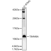 Western blot analysis of lysates from U-87MG cells, using TIMM8A Antibody at 1/600 dilution. Secondary antibody: HRP-conjugated Goat anti-Rabbit IgG (H+L) at 1/10000 dilution. Lysates/proteins: 25 µg per lane. Blocking buffer: 3% nonfat dry milk in TBST. Exposure time: 90s.