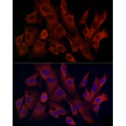 Mitochondrial Import Inner Membrane Translocase Subunit Tim8 A (TIMM8A) Antibody