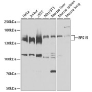 Western blot analysis of various lysates using EPS15 Antibody at 1/3000 dilution. Secondary antibody: HRP-conjugated Goat anti-Rabbit IgG (H+L) at 1/10000 dilution. Lysates/proteins: 25 µg per lane. Blocking buffer: 3% nonfat dry milk in TBST. Exposure time: 15s.