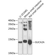 Western blot analysis of various lysates using GUCA2A Antibody at 1/1000 dilution. Secondary antibody: HRP-conjugated Goat anti-Rabbit IgG (H+L) at 1/10000 dilution. Lysates/proteins: 25 µg per lane. Blocking buffer: 3% nonfat dry milk in TBST. Exposure time: 5s.