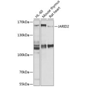 Western blot analysis of various lysates using JARID2 Antibody at 1/1000 dilution. Secondary antibody: HRP-conjugated Goat anti-Rabbit IgG (H+L) at 1/10000 dilution. Lysates/proteins: 25 µg per lane. Blocking buffer: 3% nonfat dry milk in TBST. Exposure time: 10s.