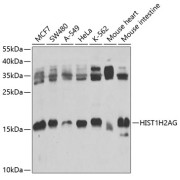 Western blot analysis of various lysates using Histone H2A.1 Antibody at 1/1000 dilution. Secondary antibody: HRP-conjugated Goat anti-Rabbit IgG (H+L) at 1/10000 dilution. Lysates/proteins: 25 µg per lane. Blocking buffer: 3% nonfat dry milk in TBST. Exposure time: 30s.