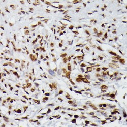 Histone H2B Type 1-C/E/F/G/I (HIST1H2BG) Antibody