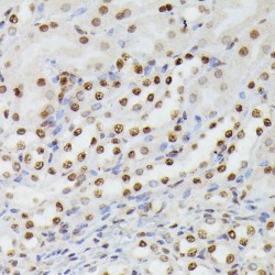 Histone H2B Type 1-C/E/F/G/I (HIST1H2BG) Antibody