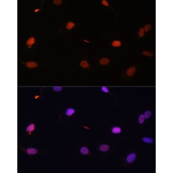 Histone H2B Type 1-C/E/F/G/I (HIST1H2BG) Antibody