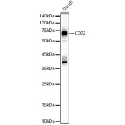 Western blot analysis of lysates from Daudi cells, using CD72 Antibody at 1/1000 dilution. Secondary antibody: HRP-conjugated Goat anti-Rabbit IgG (H+L) at 1/10000 dilution. Lysates/proteins: 25 µg per lane. Blocking buffer: 3% nonfat dry milk in TBST. Exposure time: 90s.