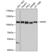 Western blot analysis of various lysates using MARS Antibody at 1/1000 dilution. Secondary antibody: HRP-conjugated Goat anti-Rabbit IgG (H+L) at 1/10000 dilution. Lysates/proteins: 25 µg per lane. Blocking buffer: 3% nonfat dry milk in TBST. Exposure time: 30s.