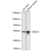 Western blot analysis of various lysates using RGS14 Antibody at 1/1000 dilution. Secondary antibody: HRP-conjugated Goat anti-Rabbit IgG (H+L) at 1/10000 dilution. Lysates/proteins: 25 µg per lane. Blocking buffer: 3% nonfat dry milk in TBST. Exposure time: 60s.