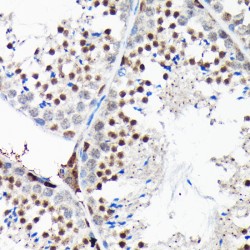 Regulator of G Protein Signaling 14 (RGS14) Antibody