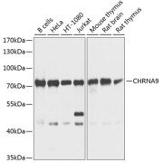 Western blot analysis of various lysates using CHRNA9 Antibody at 1/1000 dilution. Secondary antibody: HRP-conjugated Goat anti-Rabbit IgG (H+L) at 1/10000 dilution. Lysates/proteins: 25 µg per lane. Blocking buffer: 3% nonfat dry milk in TBST. Exposure time: 1s.