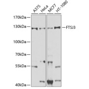 Western blot analysis of various lysates using FTSJ3 Antibody at 1/1000 dilution. Secondary antibody: HRP-conjugated Goat anti-Rabbit IgG (H+L) at 1/10000 dilution. Lysates/proteins: 25 µg per lane. Blocking buffer: 3% nonfat dry milk in TBST. Exposure time: 30s.