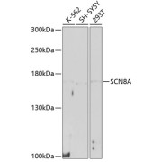 Western blot analysis of various lysates using SCN8A Antibody at 1/1000 dilution. Secondary antibody: HRP-conjugated Goat anti-Rabbit IgG (H+L) at 1/10000 dilution. Lysates/proteins: 25 µg per lane. Blocking buffer: 3% nonfat dry milk in TBST. Exposure time: 90s.