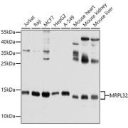 Western blot analysis of various lysates using MRPL32 Antibody at 1/1000 dilution. Secondary antibody: HRP-conjugated Goat anti-Rabbit IgG (H+L) at 1/10000 dilution. Lysates/proteins: 25 µg per lane. Blocking buffer: 3% nonfat dry milk in TBST. Exposure time: 10s.