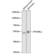 Western blot analysis of various lysates using RTN4RL1 Antibody at 1/1000 dilution. Secondary antibody: HRP-conjugated Goat anti-Rabbit IgG (H+L) at 1/10000 dilution. Lysates/proteins: 25 µg per lane. Blocking buffer: 3% nonfat dry milk in TBST. Exposure time: 20s.