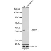 Western blot analysis of lysates from wild type (WT) and LRRC59 knockout (KO) 293T cells, using [KO Validated] LRRC59 Antibody at 1/1000 dilution. Secondary antibody: HRP-conjugated Goat anti-Rabbit IgG (H+L) at 1/10000 dilution. Lysates/proteins: 25 µg per lane. Blocking buffer: 3% nonfat dry milk in TBST. Exposure time: 1s.