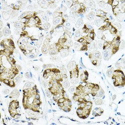 Leucine-Rich Repeat-Containing Protein 59 (LRRC59) Antibody