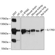 Western blot analysis of various lysates using IL17RD Antibody at 1/1000 dilution. Secondary antibody: HRP-conjugated Goat anti-Rabbit IgG (H+L) at 1/10000 dilution. Lysates/proteins: 25 µg per lane. Blocking buffer: 3% nonfat dry milk in TBST. Exposure time: 30s.