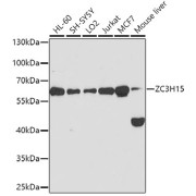 Western blot analysis of various lysates using ZC3H15 Antibody at 1/1000 dilution. Secondary antibody: HRP-conjugated Goat anti-Rabbit IgG (H+L) at 1/10000 dilution. Lysates/proteins: 25 µg per lane. Blocking buffer: 3% nonfat dry milk in TBST. Exposure time: 90s.