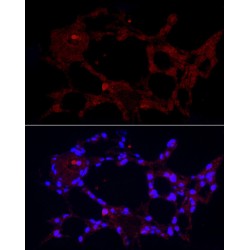 Macrophage Receptor MARCO (MARCO) Antibody