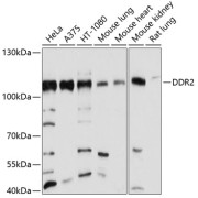 Western blot analysis of various lysates using DDR2 Antibody at 1/1000 dilution. Secondary antibody: HRP-conjugated Goat anti-Rabbit IgG (H+L) at 1/10000 dilution. Lysates/proteins: 25 µg per lane. Blocking buffer: 3% nonfat dry milk in TBST. Exposure time: 30s.