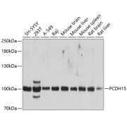 Western blot analysis of various lysates using PCDH15 Antibody at 1/1000 dilution. Secondary antibody: HRP-conjugated Goat anti-Rabbit IgG (H+L) at 1/10000 dilution. Lysates/proteins: 25 µg per lane. Blocking buffer: 3% nonfat dry milk in TBST. Exposure time: 5s.