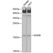 Western blot analysis of various lysates using MSMB Antibody at 1/1000 dilution. Secondary antibody: HRP-conjugated Goat anti-Rabbit IgG (H+L) at 1/10000 dilution. Lysates/proteins: 25 µg per lane. Blocking buffer: 3% nonfat dry milk in TBST. Exposure time: 60s.