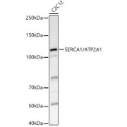 Western blot analysis of lysates from C2C12 cells, using SERCA1/ATP2A1 Antibody at 1/1000 dilution. Secondary antibody: HRP-conjugated Goat anti-Rabbit IgG (H+L) at 1/10000 dilution. Lysates/proteins: 25 µg per lane. Blocking buffer: 3% nonfat dry milk in TBST. Exposure time: 1s.