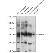 Western blot analysis of various lysates using CHRNB3 Antibody at 1/1000 dilution. Secondary antibody: HRP-conjugated Goat anti-Rabbit IgG (H+L) at 1/10000 dilution. Lysates/proteins: 25 µg per lane. Blocking buffer: 3% nonfat dry milk in TBST. Exposure time: 10s.