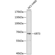 Western blot analysis of lysates from H460 cells, using KRT3 Antibody at 1/1000 dilution. Secondary antibody: HRP-conjugated Goat anti-Rabbit IgG (H+L) at 1/10000 dilution. Lysates/proteins: 25 µg per lane. Blocking buffer: 3% nonfat dry milk in TBST. Exposure time: 10s.